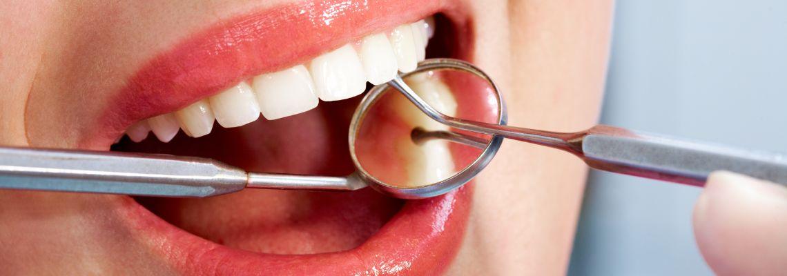 Impianto dentale o ponte tradizionale? Quale scegliere? Pro e contro.